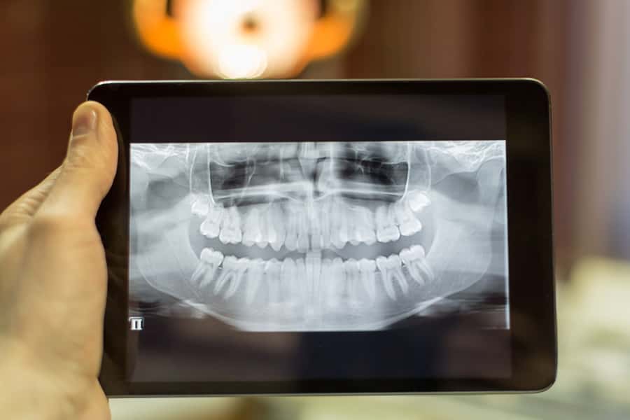 Digital Radiography in Willowbrook, IL